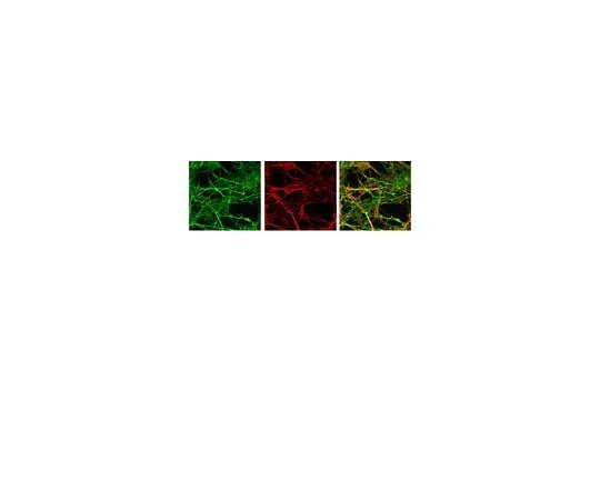 62-8446-55　Anti-Doublecortin; 50 μL　AB2253