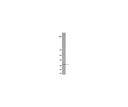 62-8384-18　Anti-REA; 200 μg　07-234