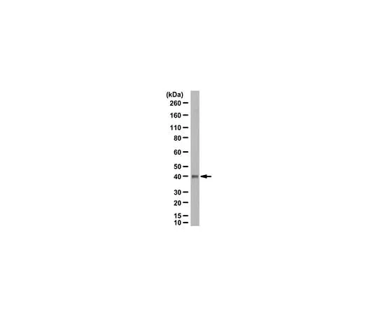 62-8459-13　Anti-PSAT1 Antibody　ABC950