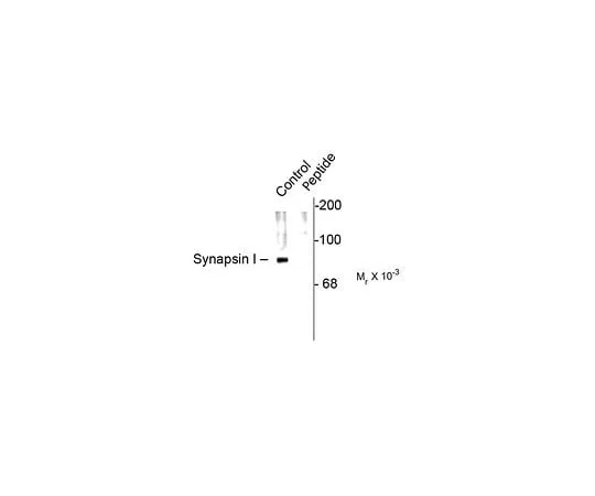 62-8453-71　Anti-phospho-Synapsin I (Ser62,Ser67); 100 μL　AB9848