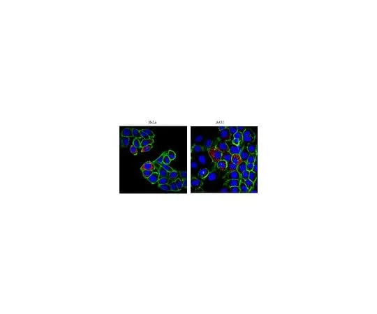 62-8447-04　Anti-p32; 100 μg　AB2991