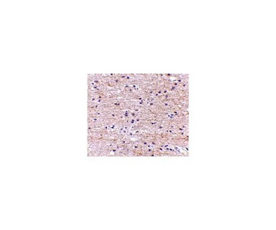 62-8462-39　Anti-SATB2　ABE600