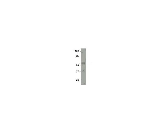 62-8385-94　Anti-SF-1; 200 μg　07-618