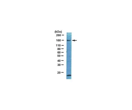 62-8381-22　Anti-IRS1; 100 μg　06-248