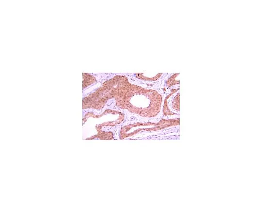 62-8387-19　Anti-PP1β; 100 μg　07-1217