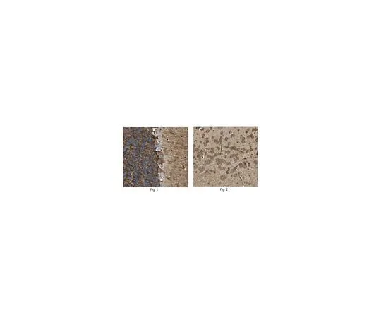 62-8455-58　Anti-Tryptophan hydroxylase 1/TPH1　AB15570-I