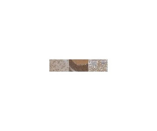 62-8455-04　Anti-D***rin　AB15299-I