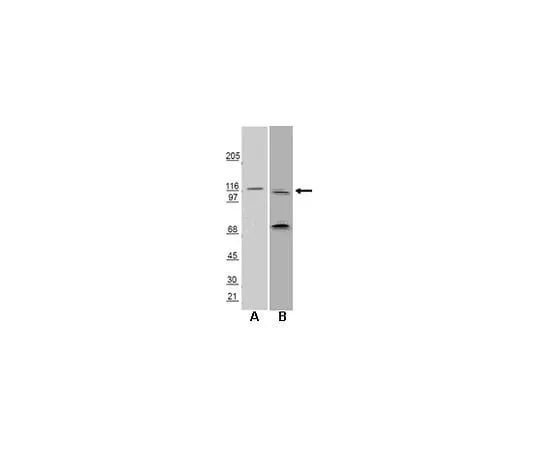 62-8453-84　Anti-Huntingtin-Interacting Protein 1 Related (HIP1R); 100 μL　AB9882