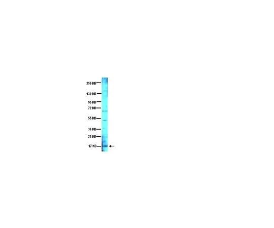 62-8445-14　Anti-Brain Derived Neurotrophic Factor; 500 μg　AB1534SP