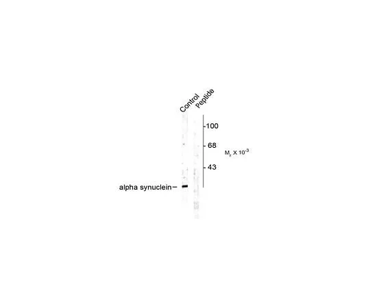 62-8453-72　Anti-phospho-Alpha Synuclein (Ser129); 100 μL　AB9850
