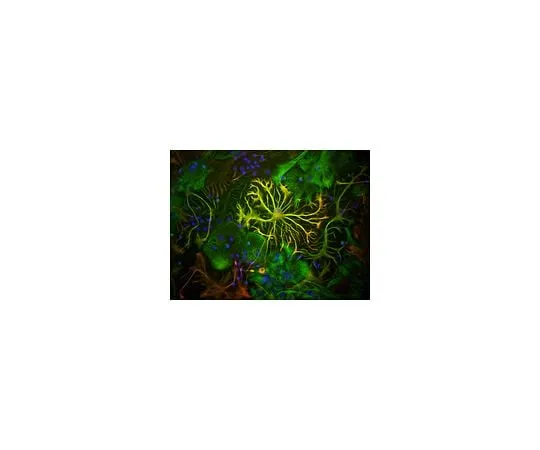62-8450-51　Anti-Glial Fibrillary Acidic Protein; 50 μL　AB5541