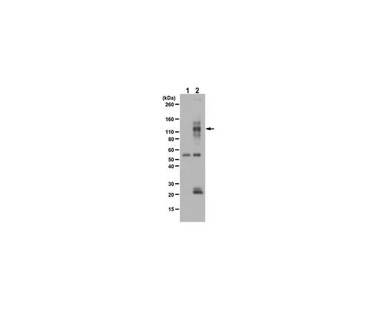 62-8464-62　Anti-phospho TIE2/TEK (Tyr992)　ABF131