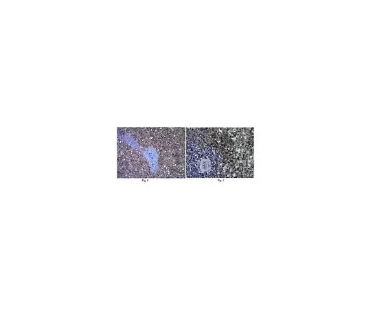 62-8383-02　Anti-Interleukin-18 (IL-18); 100 μg　06-1115