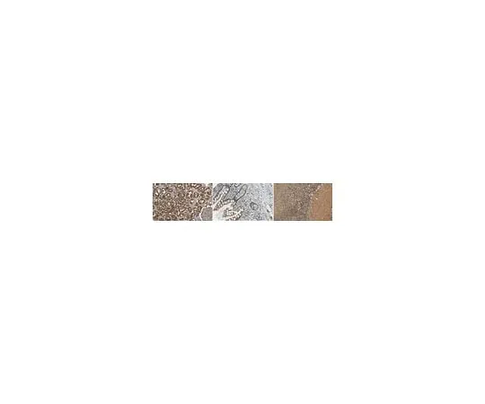 62-8385-90　Anti-Peroxiredoxin 1　07-609-I