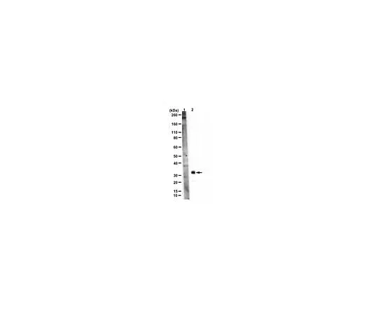 62-8456-28　Anti-mCherry　AB356481