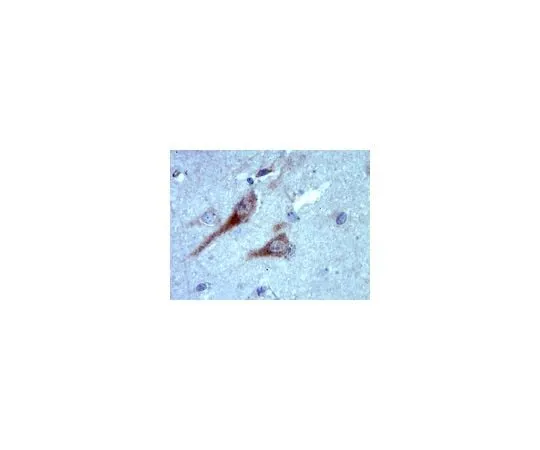 62-8465-38　Anti-RAB35; 100 μg　ABN38