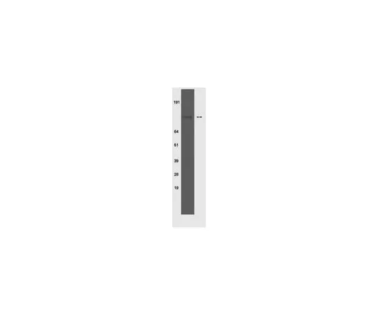 62-8368-28　Anti-phospho-Insulin Receptor (Tyr 1150/1151), clone 10C3; 100 μg　04-299