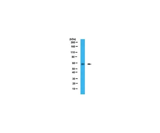 62-8458-17　Anti-PKM1　ABC439