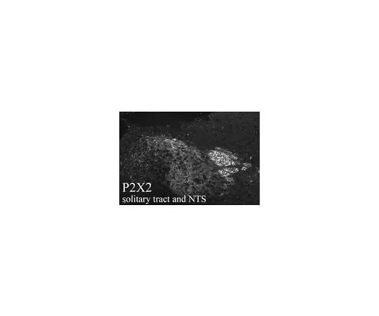 62-8451-85　Anti-P2X2 Receptor; 50 μL　AB5894