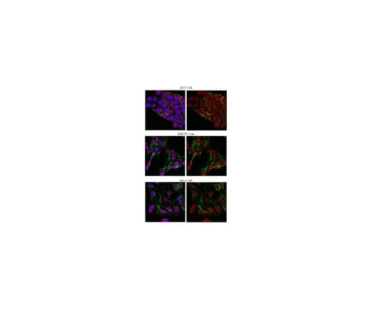 62-8375-48　Anti-phospho-Threonine, clone 20H6.1; 100 μg　5-23