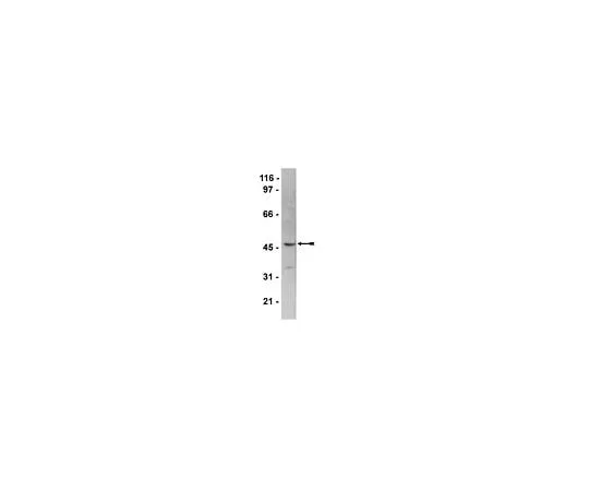 62-8385-44　Anti-HDAC8; 100 μL　07-505