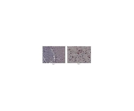62-8466-15　Anti-DBN1 Antibody Cat. No. ABN207　ABN207