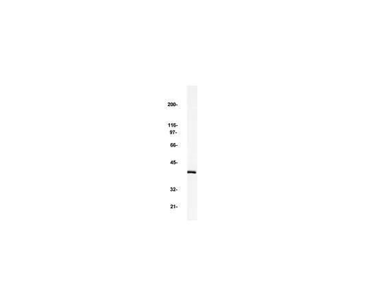 62-8381-30　Anti-MAP Kinase 2/Erk2; 200 μg　06-333
