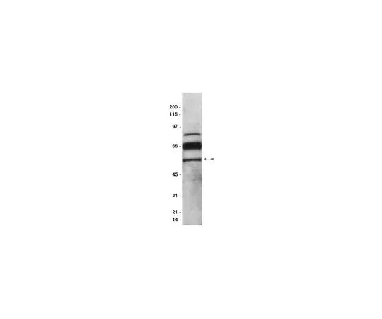 62-8384-32　Anti-PEDF; 200 μg　07-280