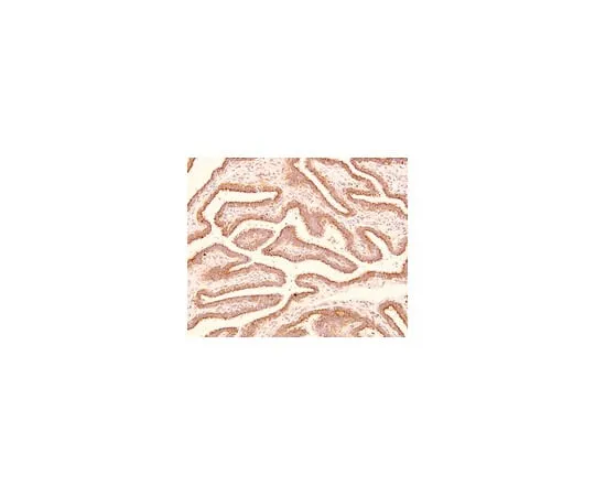 62-8373-84　Anti-Trophinin, clone 3-11; 100 μL　05-946