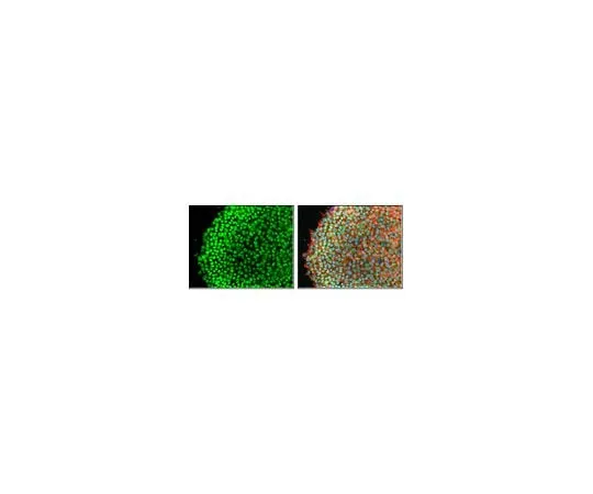 62-8459-77　Anti-SnoN　ABD104