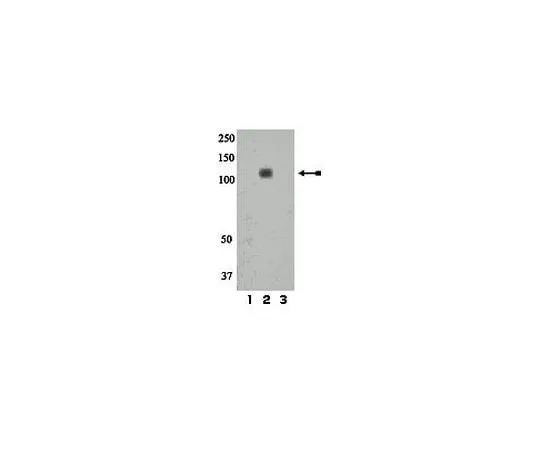 62-8386-78　anti-phospho-IR/IGF1R (Tyr1158); 100 μL　07-839