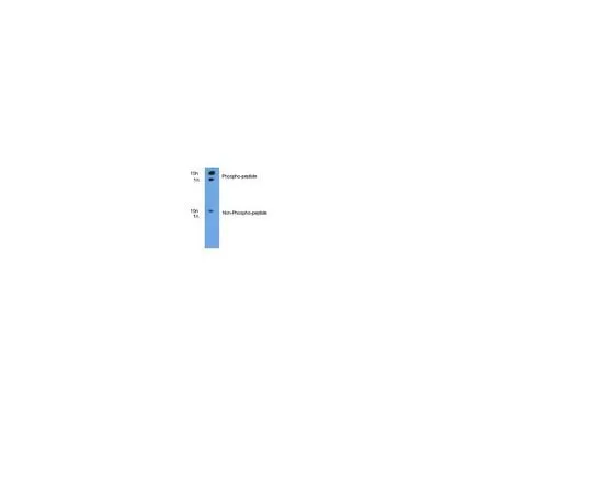 62-8454-05　anti-phospho-ITCH (pT222); 100 μg　AB10050