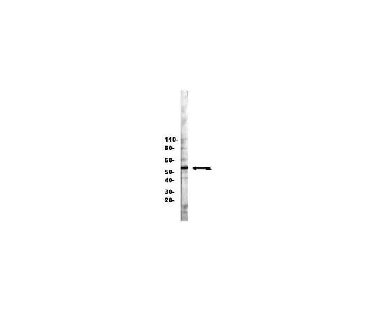 62-8386-02　Anti-HNF3β/FOXA2; 200 μg　07-633