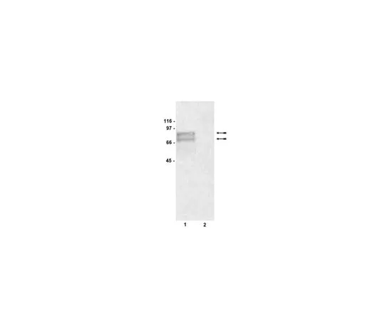 62-8372-21　Anti-Tyrosinase, clone T311; 200 μg　05-647