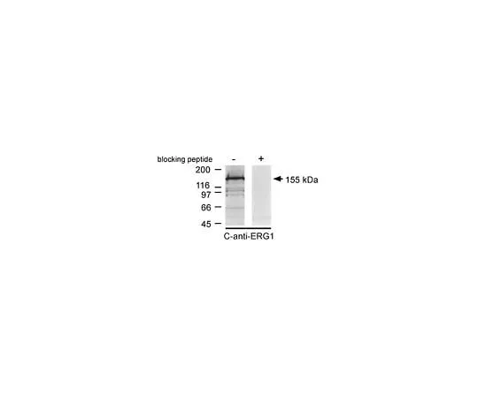 62-8451-97　Anti-Potassium Channel ERG1, C-terminus; 100 μg　AB5930