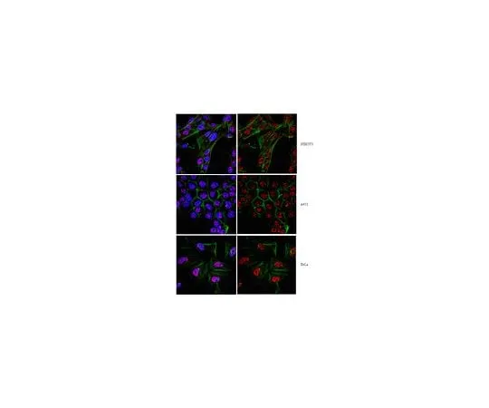 62-8459-47　Anti-Twist1 (Twist-related protein 1); 100 μg　ABD29