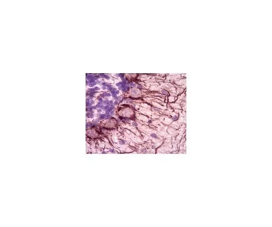 62-8465-60　Anti-Neurofilament H (200 kDa); 100 μg　ABN76