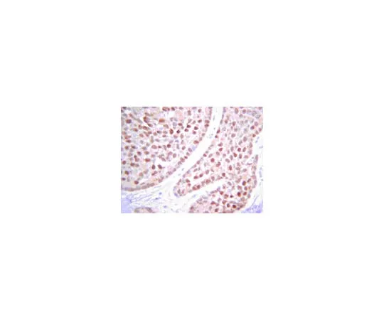 62-8367-85　Anti-PTEN, clone 6H2.1　04-035