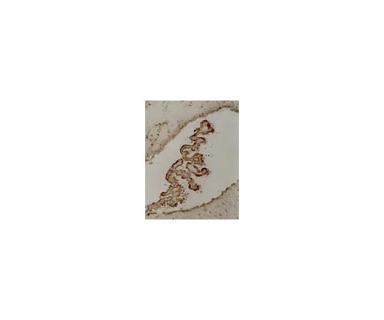 62-8370-81　Anti-Tau, clone 5E2; 200 μg　05-348