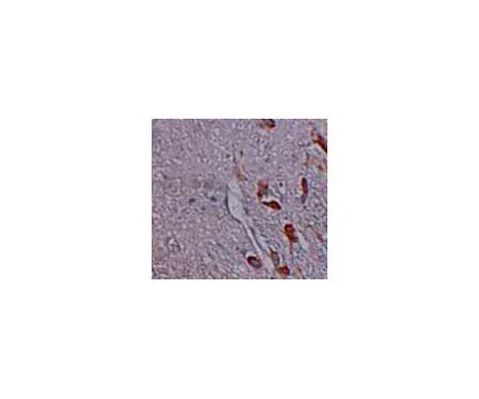 62-8467-75　Anti-LRRTM1　ABN642