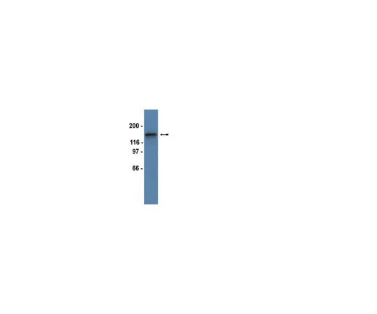 62-8368-78　Anti-PDGFRβ, clone 4A56; 100 μL　04-825