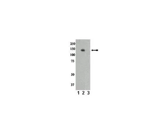 62-8386-96　anti-phospho-Pyk2/CAKβ/FAK2 (Tyr402); 100 μL　07-892