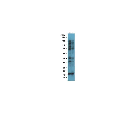 62-8374-49　Anti-O-GlcNAc, clone 9D1.E4(10); 100 μg　05-1245