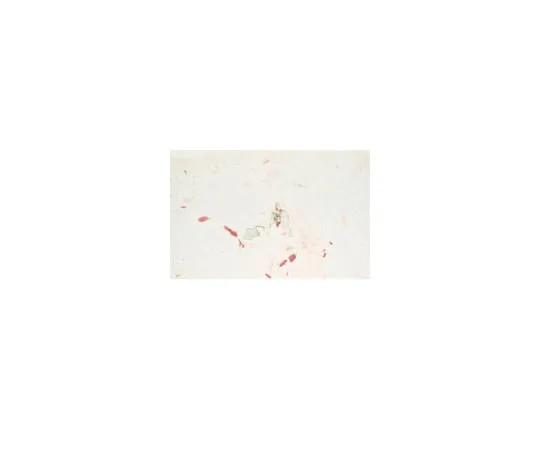 62-8374-90　Anti-Endoglin, clone P3D1; 100 μg　05-1424