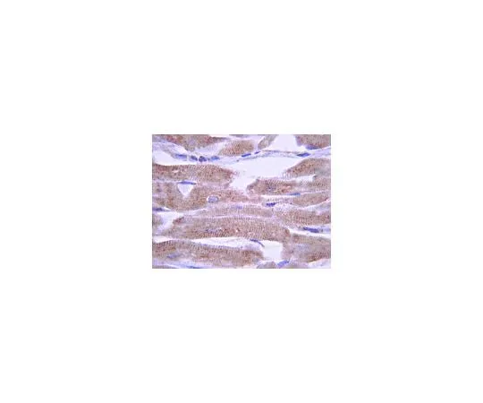 62-8451-98　Anti-Potassium Channel KvLQT1, C-terminus; 100 μg　AB5932