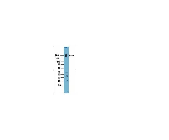 62-8389-58　Anti-PEAK1; 200 μl　09-274