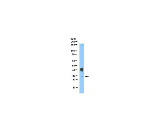 62-8459-51　Anti-SNAI1 (Snail homolog 1); 100 μg　ABD38