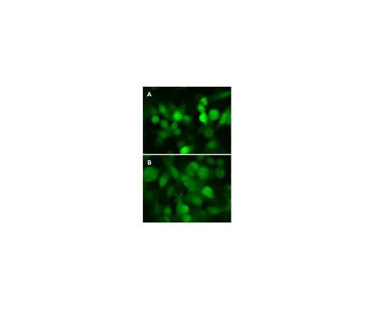 62-8394-41　LentiBrite(TM) GFP-LC3 Control Mutant Lentiviral Biosensor　17-10189