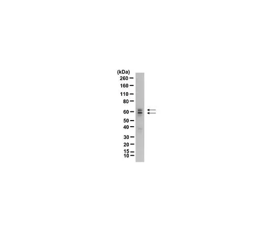 62-8465-77　Anti-GAD65; 100 μg　ABN101