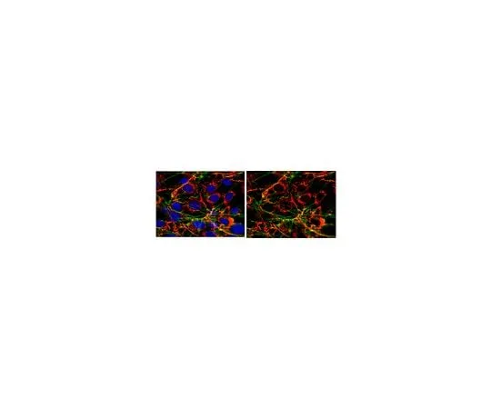 62-8446-23　Anti-Fibronectin; 100 μg　AB2033